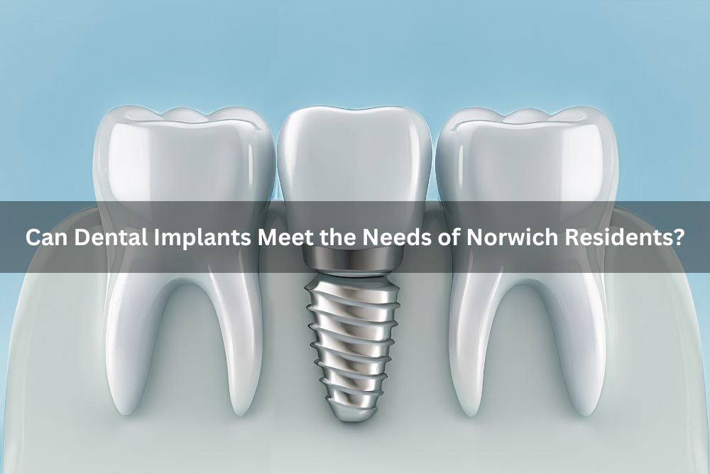 Can Dental Implants Meet the Needs of Norwich Residents?