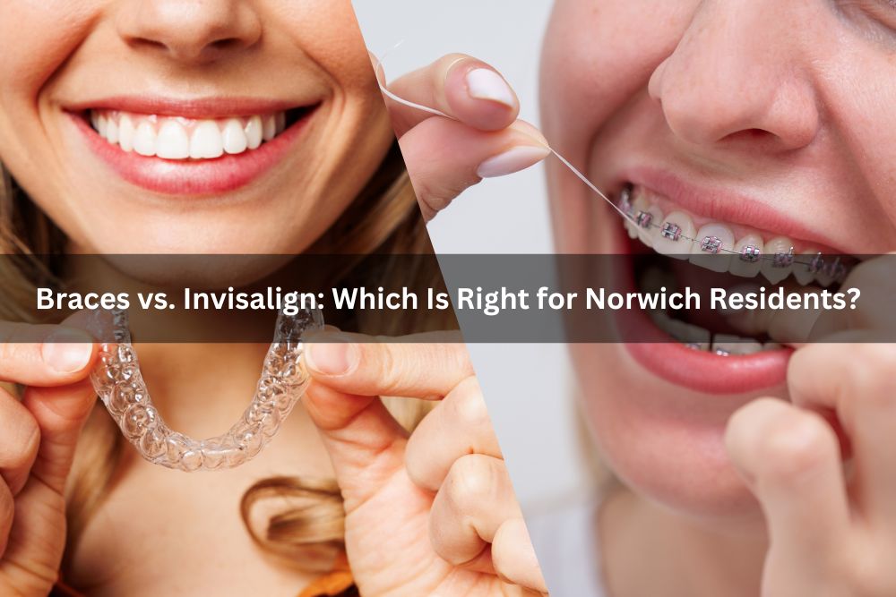 Braces vs. Invisalign: Which is Right for Norwich Residents?