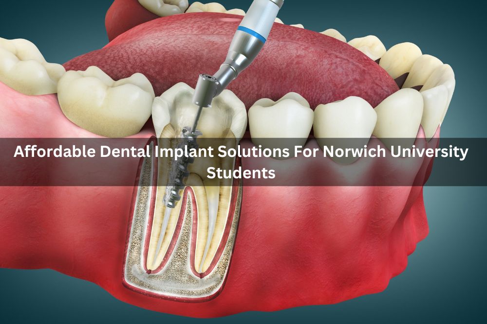 Affordable Dental Implant Solutions For Norwich University Students