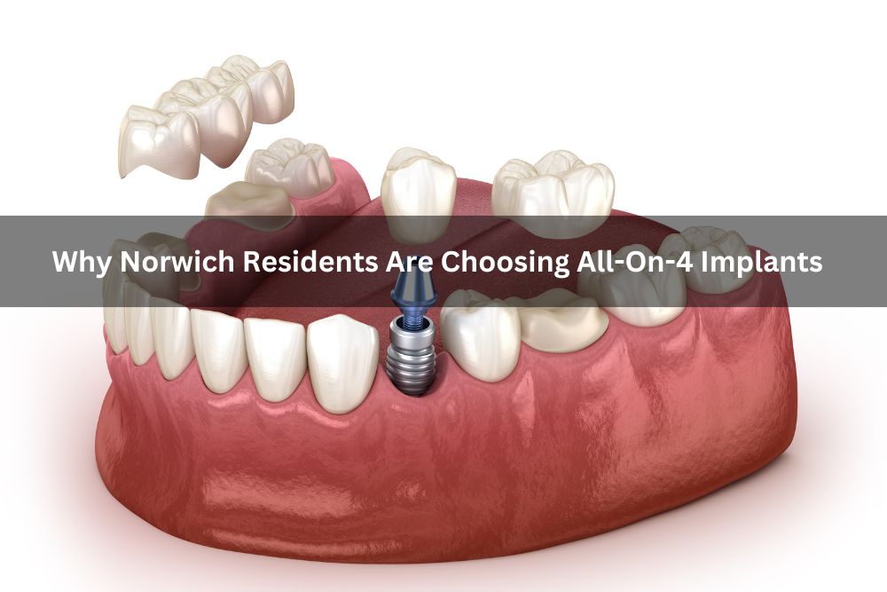 Why Norwich Residents Are Choosing All-On-4 Implants
